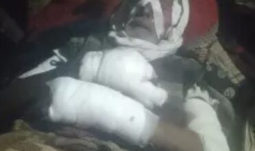 कुत्ते ने महिला को नोच-नोचकर मार डाला, क्षेत्र में भयावह स्थिति