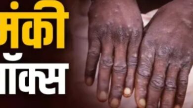मंकी पॉक्स ने भारत में दी दस्तक, विदेश से आए पुरुष में मिले लक्षण