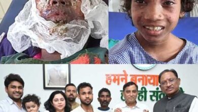 आईईडी धमाके में घायल बालिका का चेहरा वापस मिला, सीएम ने पढ़ाई सहित सभी जिम्मेदारी लेने की घोषणा आईईडी धमाके में घायल बालिका का चेहरा वापस मिला, सीएम ने पढ़ाई सहित सभी जिम्मेदारी लेने की घोषणा