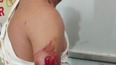 शेर के हमले से किसान गंभीर रूप से घायल