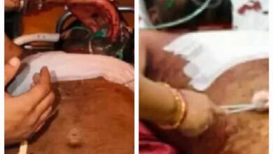 सैलून की दुकान में हुई चाकूबाजी की वारदात, दो घायल, आरोपी फरार