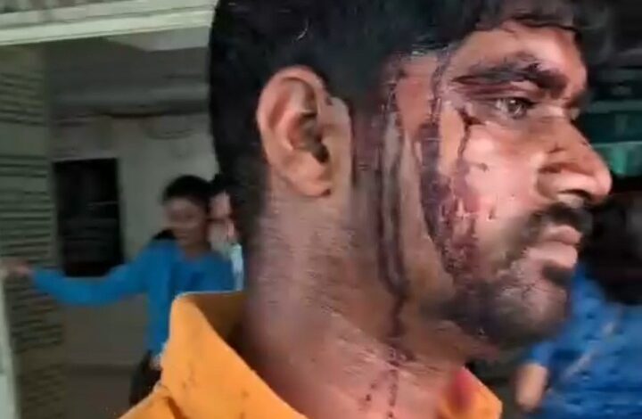 जमीन को लेकर दो पक्ष भिड़े, एक का सिर फूटा जमीन को लेकर दो पक्ष भिड़े, एक का सिर फूटा