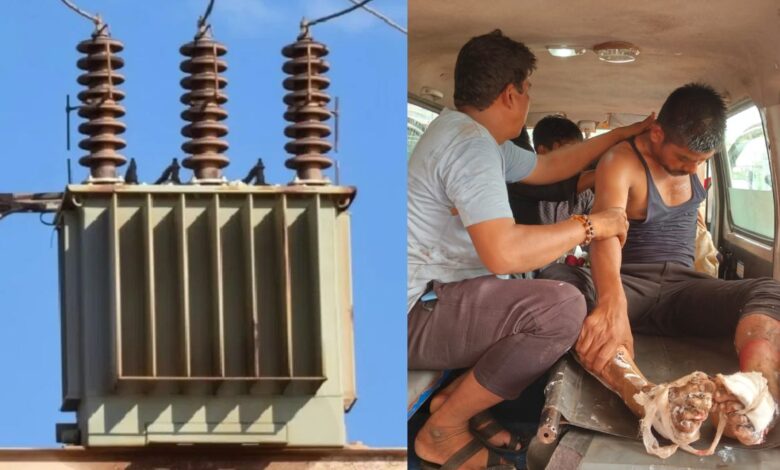 बिजली विभाग की लापरवाही से ट्रांसफार्मर में डीओ चढ़ाने के दौरान झुलसे ठेका श्रमिक बिजली विभाग की लापरवाही से ट्रांसफार्मर में डीओ चढ़ाने के दौरान झुलसे ठेका श्रमिक