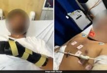 ऑस्ट्रेलिया में फिर भारतीय छात्र पर नस्लीय हमला