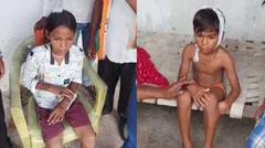 पढाई करते वक्त अचानक गिरा प्लास्टर, छात्रा का फटा सर पढाई करते वक्त अचानक गिरा प्लास्टर, छात्रा का फटा सर