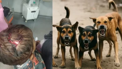 आवारा कुत्तों का आतंक : घर के बाहर खेलती बच्ची पर किया हमला आवारा कुत्तों का आतंक : घर के बाहर खेलती बच्ची पर किया हमला