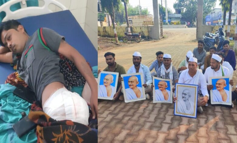 बलौदाबाजार में पुलिस कार्रवाई के दौरान युवक घायल, कांग्रेस ने थाना प्रभारी पर अत्याचार का लगाया आरोप बलौदाबाजार में पुलिस कार्रवाई के दौरान युवक घायल, कांग्रेस ने थाना प्रभारी पर अत्याचार का लगाया आरोप