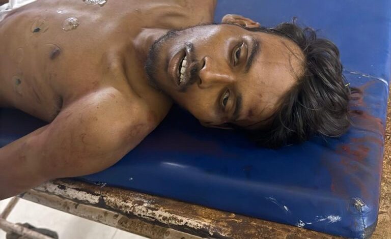 प्रेमिका के साथ मातर देखने पहुंचा प्रेमी, लड़की के भाई ने की हत्या प्रेमिका के साथ मातर देखने पहुंचा प्रेमी, लड़की के भाई ने की हत्या