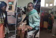 गैस सिलेंडर गैस रिसाव से लगी आग से घर के 5 सदस्य झुलसे