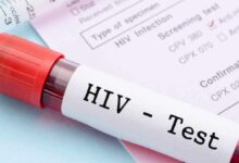 एचआईवी मरीजों के लिए नई सुरक्षा और गोपनीयता गाइडलाइन