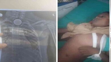 कोरबा में दर्दनाक हादसा: 8 वर्षीय बच्चे की सिक्का निगलने से मौत कोरबा में दर्दनाक हादसा: 8 वर्षीय बच्चे की सिक्का निगलने से मौत