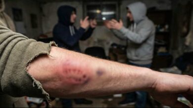 शहडोल में पारिवारिक झगड़ा: दांत से काटने तक की वारदात