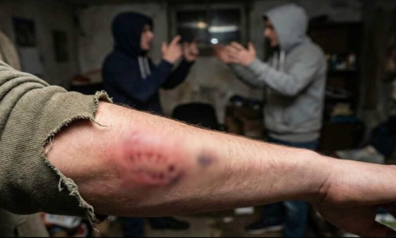 शहडोल में पारिवारिक झगड़ा: दांत से काटने तक की वारदात