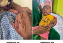 चिरायु योजना बच्चों के लिए भी बनी वरदान, तीनों बच्चों के चेहरे की लौटी मुस्कान