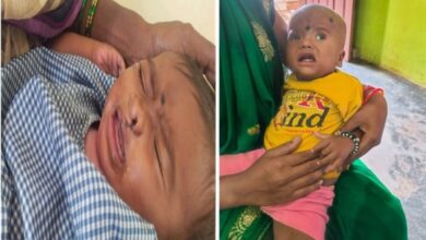 चिरायु योजना बच्चों के लिए भी बनी वरदान, तीनों बच्चों के चेहरे की लौटी मुस्कान