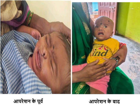 चिरायु योजना बच्चों के लिए भी बनी वरदान, तीनों बच्चों के चेहरे की लौटी मुस्कान चिरायु योजना बच्चों के लिए भी बनी वरदान, तीनों बच्चों के चेहरे की लौटी मुस्कान