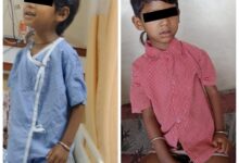 चिरायु योजना से नित्या को मिला नया जीवन