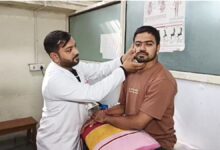 ठंड के बीच बेल्स पाल्सी के मामले बढ़े ठंड के बीच बेल्स पाल्सी के मामले बढ़े