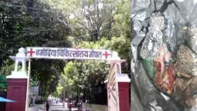 अस्पताल में जले हुए जुड़वां नवजात शवों का खुलासा, पुलिस जांच में जुटी