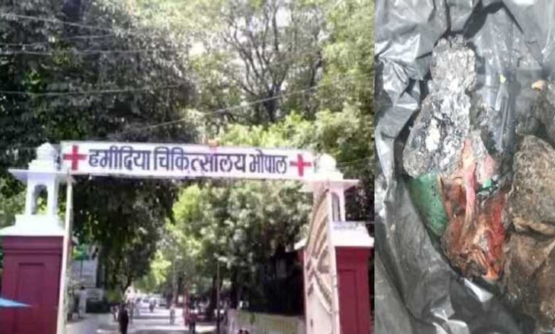 अस्पताल में जले हुए जुड़वां नवजात शवों का खुलासा, पुलिस जांच में जुटी अस्पताल में जले हुए जुड़वां नवजात शवों का खुलासा, पुलिस जांच में जुटी