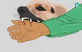 रेबीज़ पर सतर्कता ही सुरक्षा का सबसे बड़ा उपाय, लापरवाही नहीं, जागरूकता और समय पर इलाज ही जीवन की गारंटी रेबीज़ पर सतर्कता ही सुरक्षा का सबसे बड़ा उपाय, लापरवाही नहीं, जागरूकता और समय पर इलाज ही जीवन की गारंटी