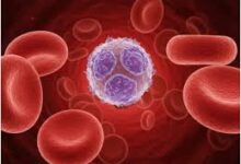 2047 तक सिकलसेल मुक्त भारत का संकल्प, छत्तीसगढ़ में 1.65 करोड़ से अधिक की जांच