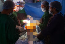 अम्बेडकर अस्पताल में टोटल हिप रिप्लेसमेंट एवं टोटल नी रिप्लेसमेंट की सुविधा उपलब्ध