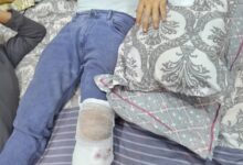 “आप” के कार्यकारी प्रदेश अध्यक्ष जायसवाल सड़क हादसे में गंभीर रूप से घायल