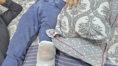 “आप” के कार्यकारी प्रदेश अध्यक्ष जायसवाल सड़क हादसे में गंभीर रूप से घायल