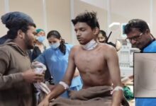 प्रतिबंधित चाइना डोर से युवक गंभीर रूप से घायल, गले में 12 टांके