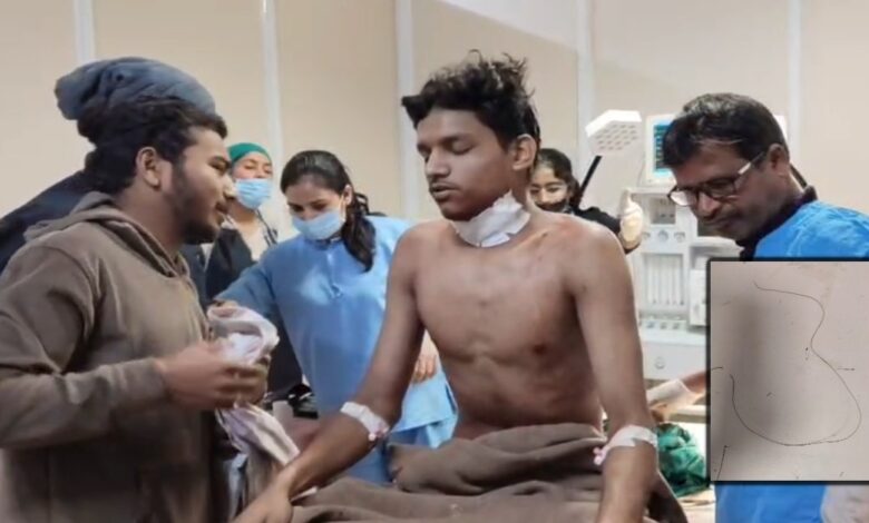प्रतिबंधित चाइना डोर से युवक गंभीर रूप से घायल, गले में 12 टांके