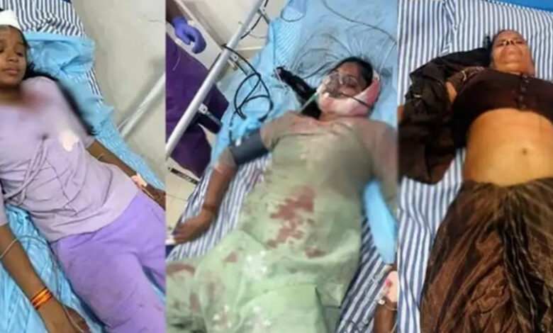 शिवरीनारायण मेले में झूले के केबिन का जाल खुलते ही छह लोग गिरे नीचे