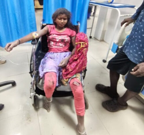 अनियंत्रित ट्रैक्टर पलटा, 4 मजदूर हुए घायल