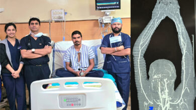 चाकू से कटी मुख्य धमनी, सबक्लेवियन आर्टरी को जोड़कर मेकाहारा के डॉक्टरों ने बचाया युवक का हाथ