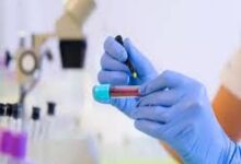 उच्च शिक्षा विभाग में प्रयोगशाला तकनीशियनों की नियुक्ति, चयनित अभ्यर्थियों को मिला पदस्थापना आदेश