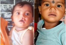 शासन की योजना से दूर हुई बेटी के भविष्य की चिंता, चिरायु दल ने लौटाई मासूम रंजना की मुस्कान