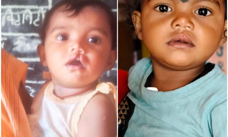 शासन की योजना से दूर हुई बेटी के भविष्य की चिंता, चिरायु दल ने लौटाई मासूम रंजना की मुस्कान शासन की योजना से दूर हुई बेटी के भविष्य की चिंता, चिरायु दल ने लौटाई मासूम रंजना की मुस्कान