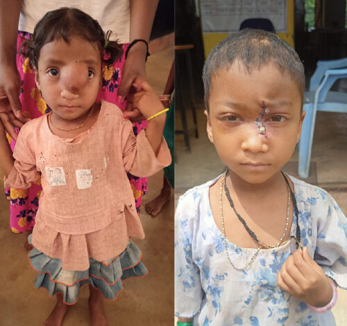 पिता के साये और आर्थिक तंगी के बीच चिरायु योजना बनी सहारा,अंजलि को मिला नया जीवन