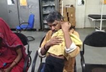 पागल कुत्ते ने पाटी नगर में 4 लोगों पर हमला किया, बच्ची भी जख्मी