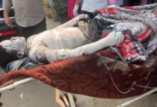 खरसिया प्लांट में जोरदार धमाका 8 मजदूर झुलसे, 9 माह के मासूम की हालत गंभीर