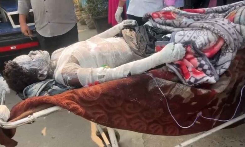 खरसिया प्लांट में जोरदार धमाका 8 मजदूर झुलसे, 9 माह के मासूम की हालत गंभीर