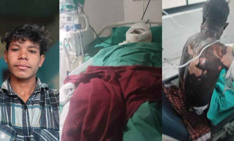 खरसिया औद्योगिक हादसा 3 घायलों की मौत, परिवार में मातम