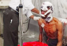 भालू ने किया ग्रामीण पर हमला, उपचार के लिए भेजा गया रायपुर