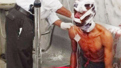 भालू ने किया ग्रामीण पर हमला, उपचार के लिए भेजा गया रायपुर