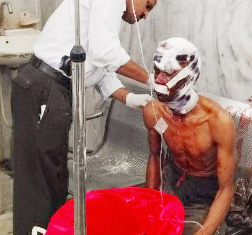 भालू ने किया ग्रामीण पर हमला, उपचार के लिए भेजा गया रायपुर