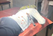 स्कूटी से अस्पताल जा रही नर्स पर बाइक सवार युवक ने किया चाकू से हमला