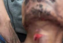 पिता ने 6 साल की बेटी पर चाकू से किया खुद किया गला कांटकर खुदकुशी की कोशिश, रायपुर रेफर