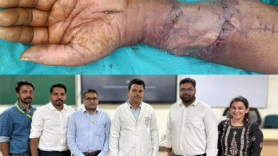 एम्स रायपुर के डॉक्टरों ने 70 वर्षीय बुजुर्ग का कटा हुआ हाथ सफलतापूर्वक जोड़ा
