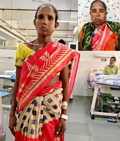 संजीवनी बना मेगा सुपर स्पेशलिटी हेल्थ कैंप, बुधरी को प्रशासन की तत्परता से एम्स रायपुर में मिला नया जीवन