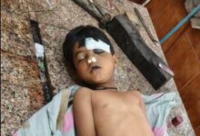 खेलने के दौरान छतसे गिरने पर मासूम की मौत